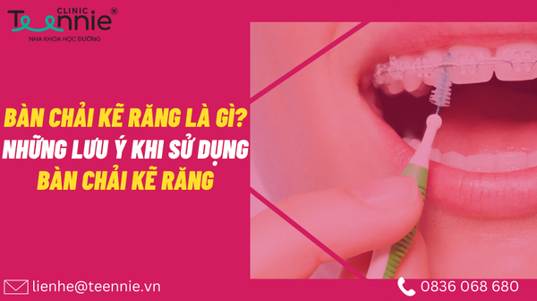 ban chai ke rang 84f366ed669d41959a5f5a72ea55a4a4 grande