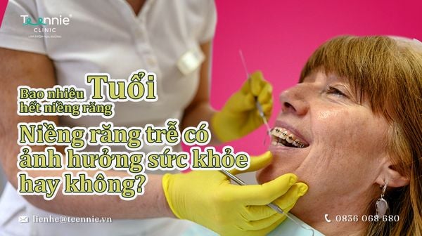 bao nhieu tuoi het nieng rang bia 7ca5d6b24c5947d6917b54bf6e6cee02 grande