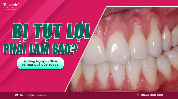 bi tut loi phai lam sao nhung nguyen nhan va hau qua cua tut loi 2f5d83e4a8304faa902add068b242320 grande