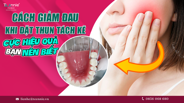 cach giam dau khi dat thun tach ke hieu qua ban nen biet 5c68f11aa71847e897cca4bf7864132b grande