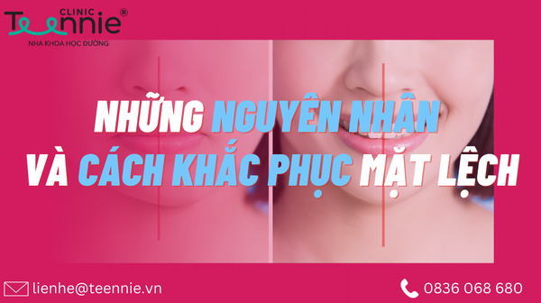 cach khac phuc mat lech 0bab238ec9f848e0972ef82960164a0d grande