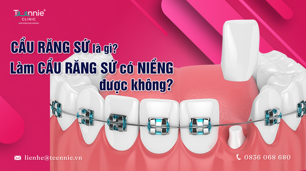 cau rang su la gi lam cau rang su co nieng duoc khong 27bb0750ba7245ee8e796d822a44ffcd grande