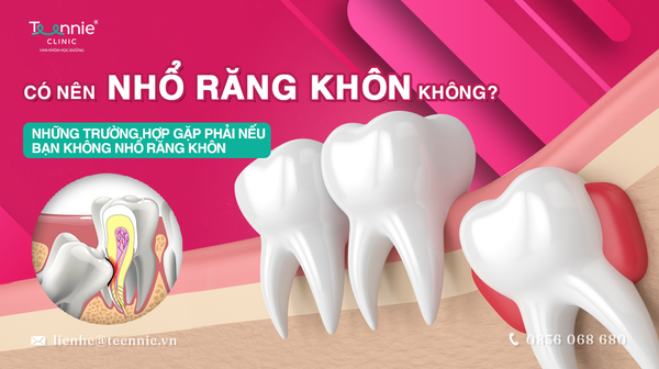 co nen nho rang khon khong dabb537a12734038a42131fc00e69092 grande