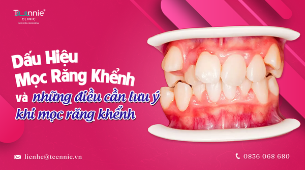 dau hieu moc rang khenh eba57900207846629dcdf1a4a01b4c07 grande