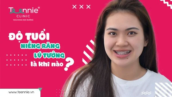 do tuoi nieng rang ly tuong teennie ffe4d863677c4df29d7f5fc43f9613fc grande
