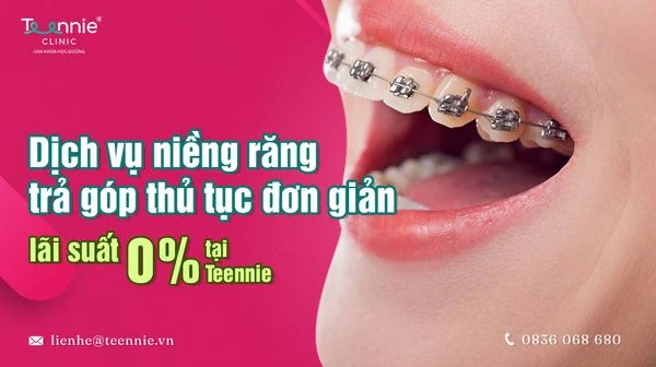 ich vu nieng rang tra gop thu tuc don gian lai suat 0 tai teennie bia cb7b19249ec5448199747b6aa8064fa8 grande