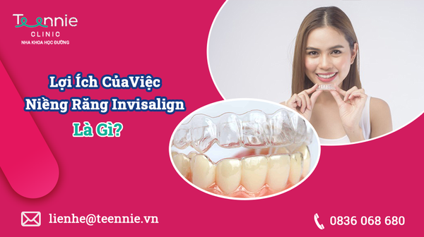 invisalign la gi 860ff9f48d224680beebc9dd191a3a52 grande