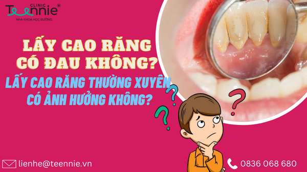 lay cao rang co dau khong cdc222ffe3d24246b5cac80b96fae332 grande