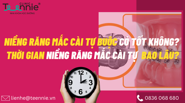 mac cai tu buoc co tot khong 21fd8a0e9c73413cbca6bd6ac672762d grande