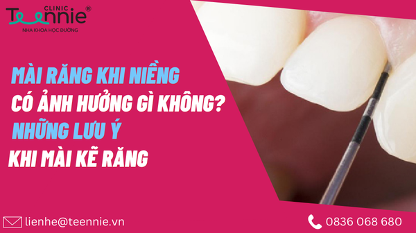 mai rang khi nieng co anh huong gi khong 2ac2e67de87f4a6d9937585819cebff2 grande