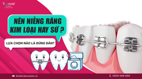 nen nieng rang kim loai hay su lua chon nao la dung dan 2c4bb3718f7f464a982d3ae521299b4a grande