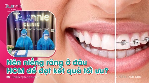 nen nieng rang o dau hcm de dat ket qua toi uu 23837bae82904c63b61490b2631679c4 grande