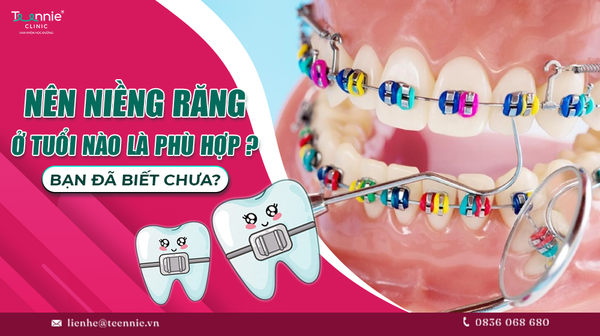 nen nieng rang o tuoi nao phu hop ban da biet chua 9a723034c8f34adbaf86d510c9787731 grande