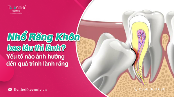 nho rang khon bao lau thi lanh 24ffa2594ef74a178ca13b102bd6e2de grande