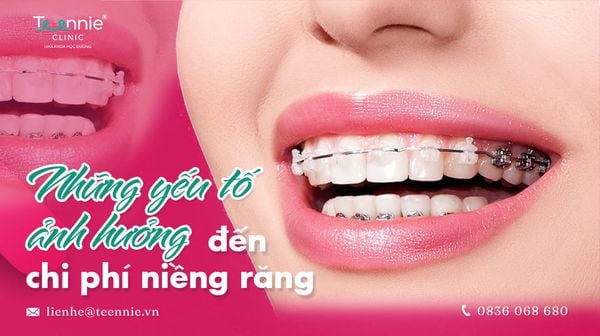 nhung yeu to anh huong den chi phi nieng rang fbe7d5f5ef36448db819795b01c9726d grande