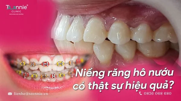 nieng rang ho nuou co that su hieu qua b9034c43dd2e4ff883f24b19317437fe grande