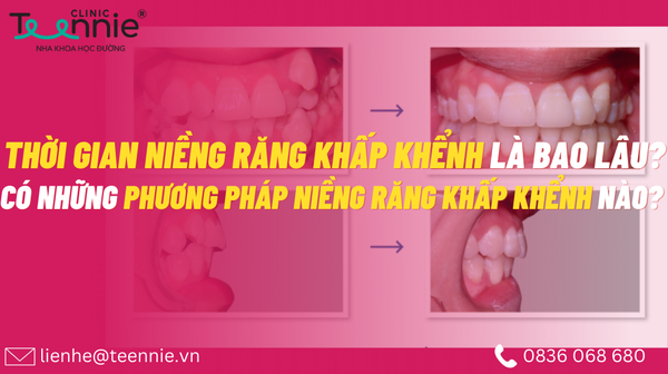 nieng rang khap khenh 1ea3107f1b0f4488869ba4d4555ab32a grande