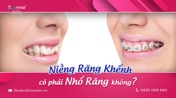 nieng rang khenh co phai nho rang khong 176b5b51395d44cab87f8a19eae53130 grande
