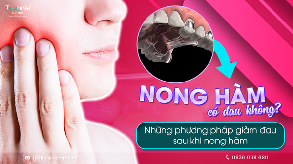 nong ham co dau khong phuong phap giam sau sau khi nong ham a28b89d077c440c2a31d14879ba917b2 grande