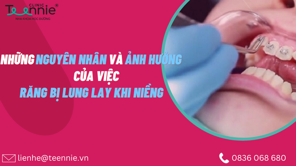 rang bi lung lay khi nieng 9199fe21f2014877aa9630beea6369ca grande