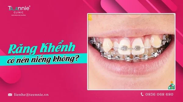 rang khenh co nen nieng khong 8f86217a3557418b8533437807facc04 grande