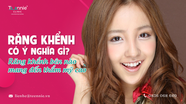 rang khenh co y nghia gi 5e2df569e69c4898a5829c121ce57a3c grande