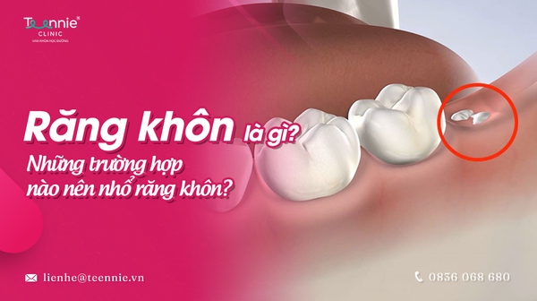 rang khon la gi 838a50b54ff64871bdc63fa5ec90818b grande