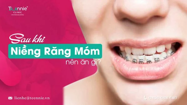 sau khi nieng rang mom nen an gi fb0f641b7ffa4565b5f01c9f0283a1aa grande