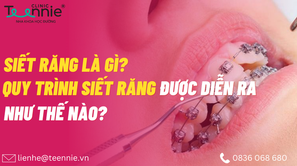 siet rang la gi aa545c6379b34d5ca41519ac9c5257dd grande