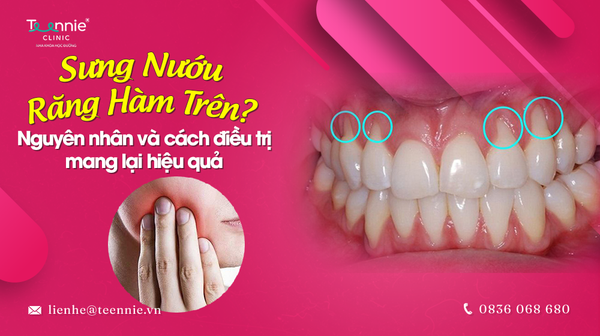 sung nuou rang ham tren 8572510b8bd94cda915c1316503ef042 grande