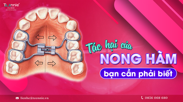 tac hai cua nong ham ma ban can phai biet 15b25de58b2949b496187121b33fff77 grande
