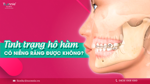 tinh trang ho ham co nieng rang duoc khong 98c1ede80143489b812f8d268f0c2451 grande