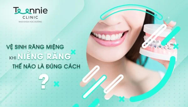 ve sinh rang mieng khi nieng rang dung cach 2 b4f3056b7a9d474fbf97b880beee1c47 grande