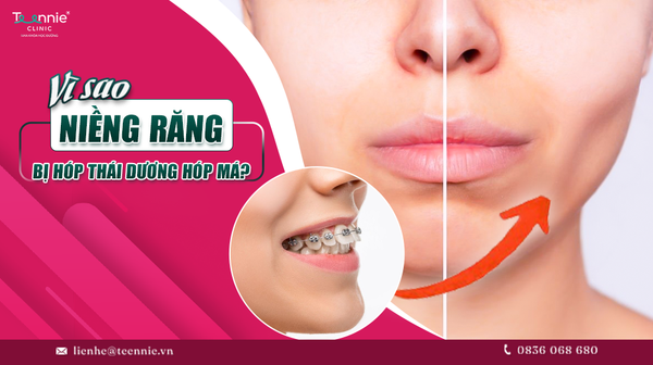 vi sao nieng rang bi hop thai duong hop ma 389a2e2ae95c43549667c5fb55c4073c grande