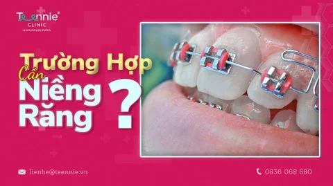 anh bia truong hop nieng rang b20d0d0ddf064c94bb88e1a92431feb5 large