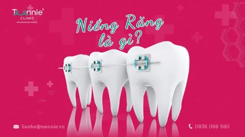 neing rang la gi anh bia dcacab11434644b68532544cc71ad617 large