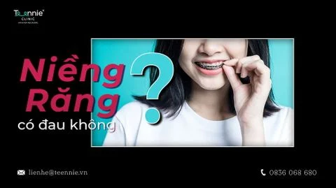 nieng rang co dau khong anh bia 60e1afa8893e4843b7867907257fb4cf large