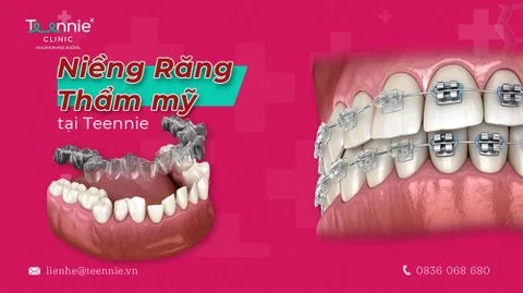 nieng rang tham my anh bia 1 2e6fc26230df4a749f6337348eda60b7 large