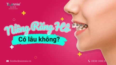 teenie nieng rang ho co lau khong anh bia d316b02281164c10894711e0028aec08 large