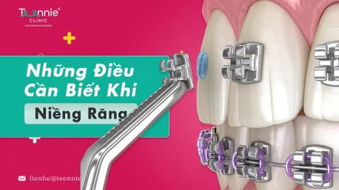 teenie nieng rang nhung dieu can biet anh bia 4a69201f87ca4a45bd840c237b5a9bd5 large