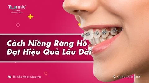 cach nieng rang ho dat hieu qua bia 7aac0f37a2f3456d9821849ca9751038 large