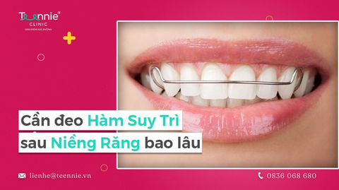 can deo ham duy tri sau nieng rang bao lau bia 39f90a0fd8b147d593b259f060c90097 large