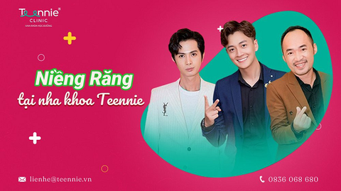 kinh nghiem nieng rang 3 e4bfc95799e14a178115cf5aef80a001 large