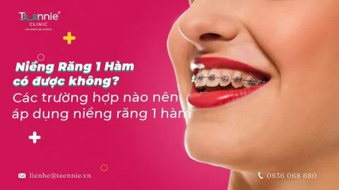 nieng rang 1 ham co duoc khong bia 4e6dc36d34b04715ba5ceeb086232a8e large