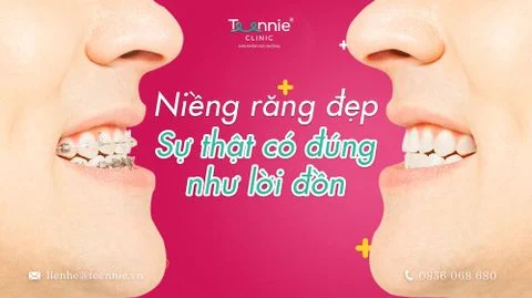 nieng rang dep su that co dung nhu loi don bia 582f62e7d0fa4ab581db621c96aecc10 large