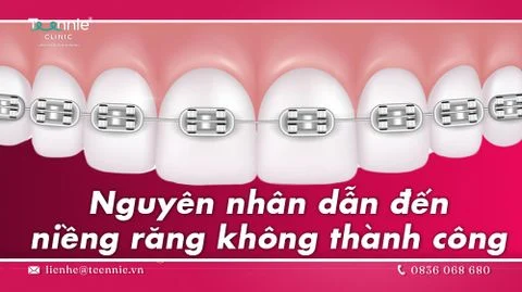 nieng rang khong thanh cong bia ab50834fe149474f9ec9579879ea8c6f large