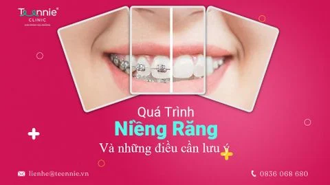 qua trinh nieng rang chuan 8283e0516dde474891dd565eb5cd1068 large
