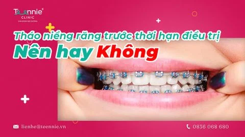 thao nieng rang truoc thoi han bia 573f2bb7fafa4f12b25a61f4084d94fd large