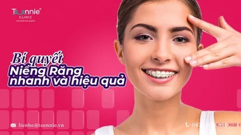 bi quyet nieng rang nhanh va hieu qua bia 2d6dc70c47604fefaccf4fd413ea0d7b large