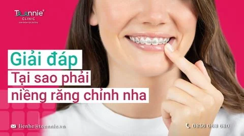 giai dap tai sao phai nieng rang chinh nha bia b477376503e240a799827933b4e567f2 large